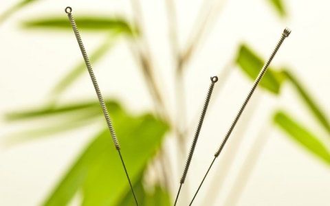 Close-up of metal acupuncture needles standing upright against a blurred green plant background.